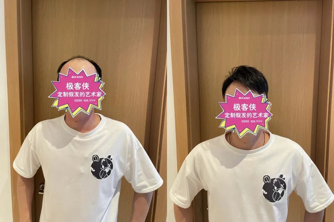 织发补发前后效果对比